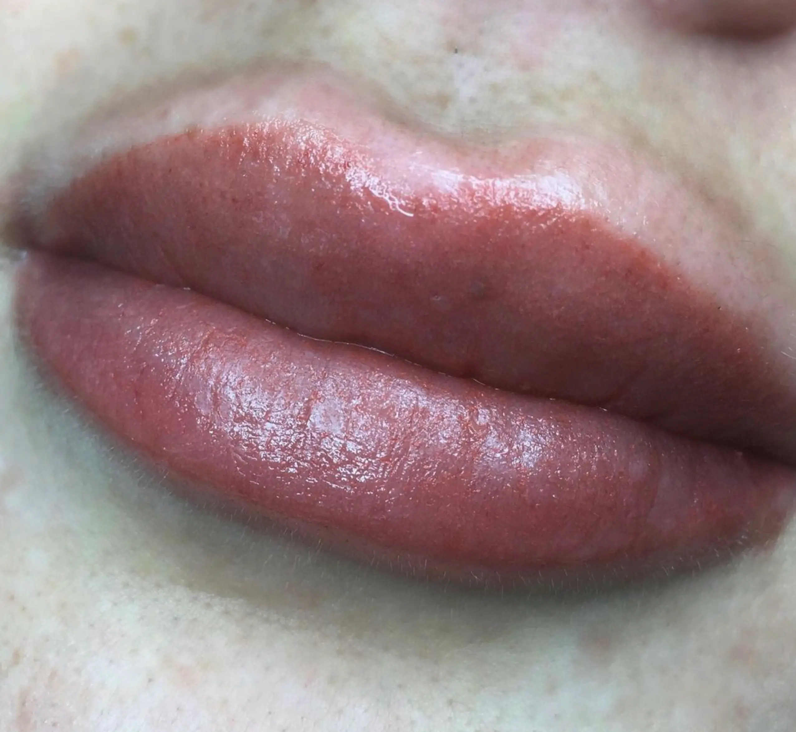 Travel and beauty Australia | Lip Tattoo Correction vs Laser Removal: What’s Better?