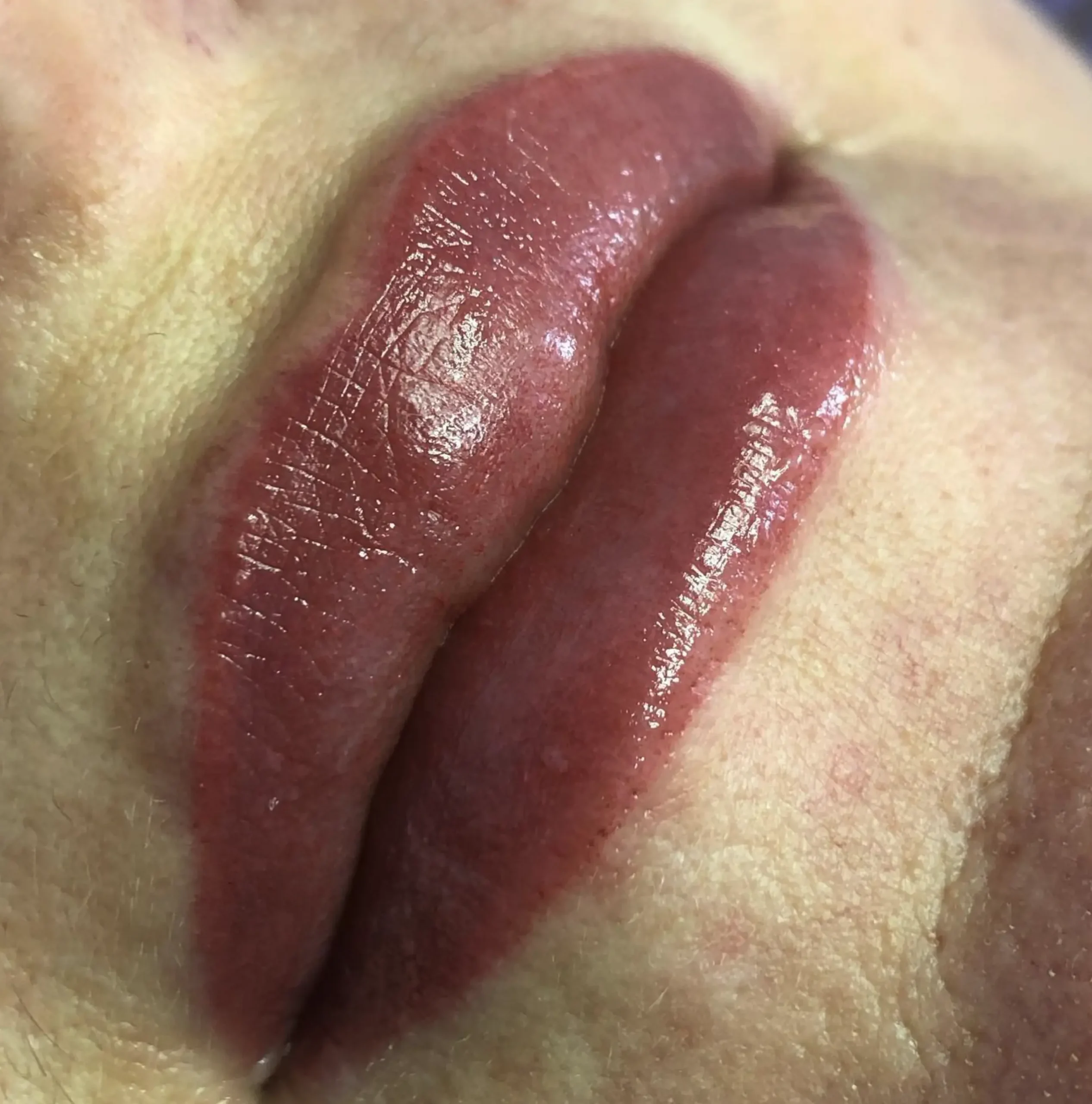 Travel and beauty Australia | Lip Tattoo Correction vs Laser Removal: What’s Better?