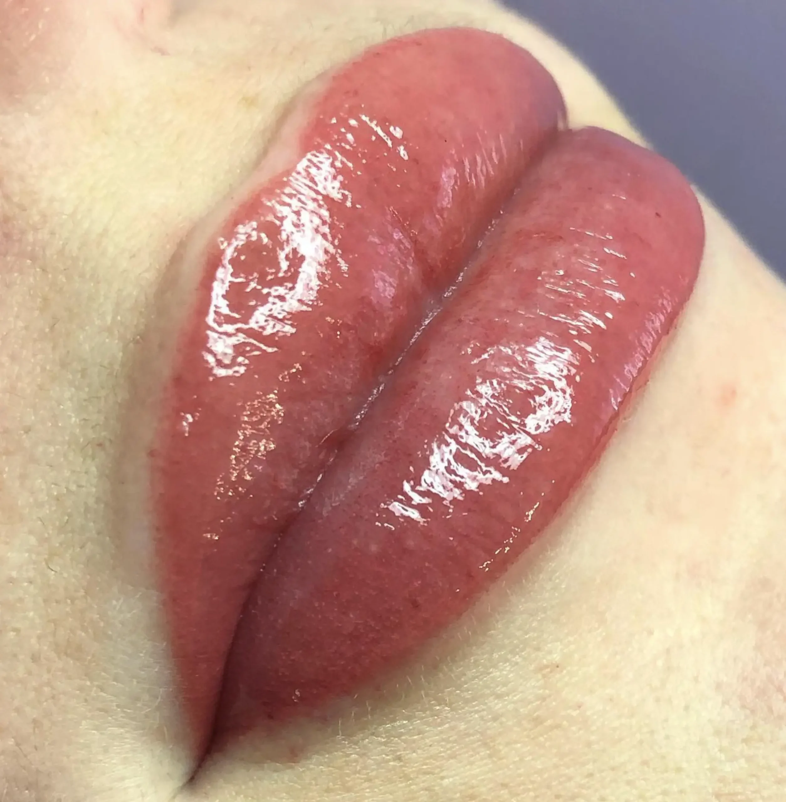 Travel and beauty Australia | Lip Tattoo Correction vs Laser Removal: What’s Better?