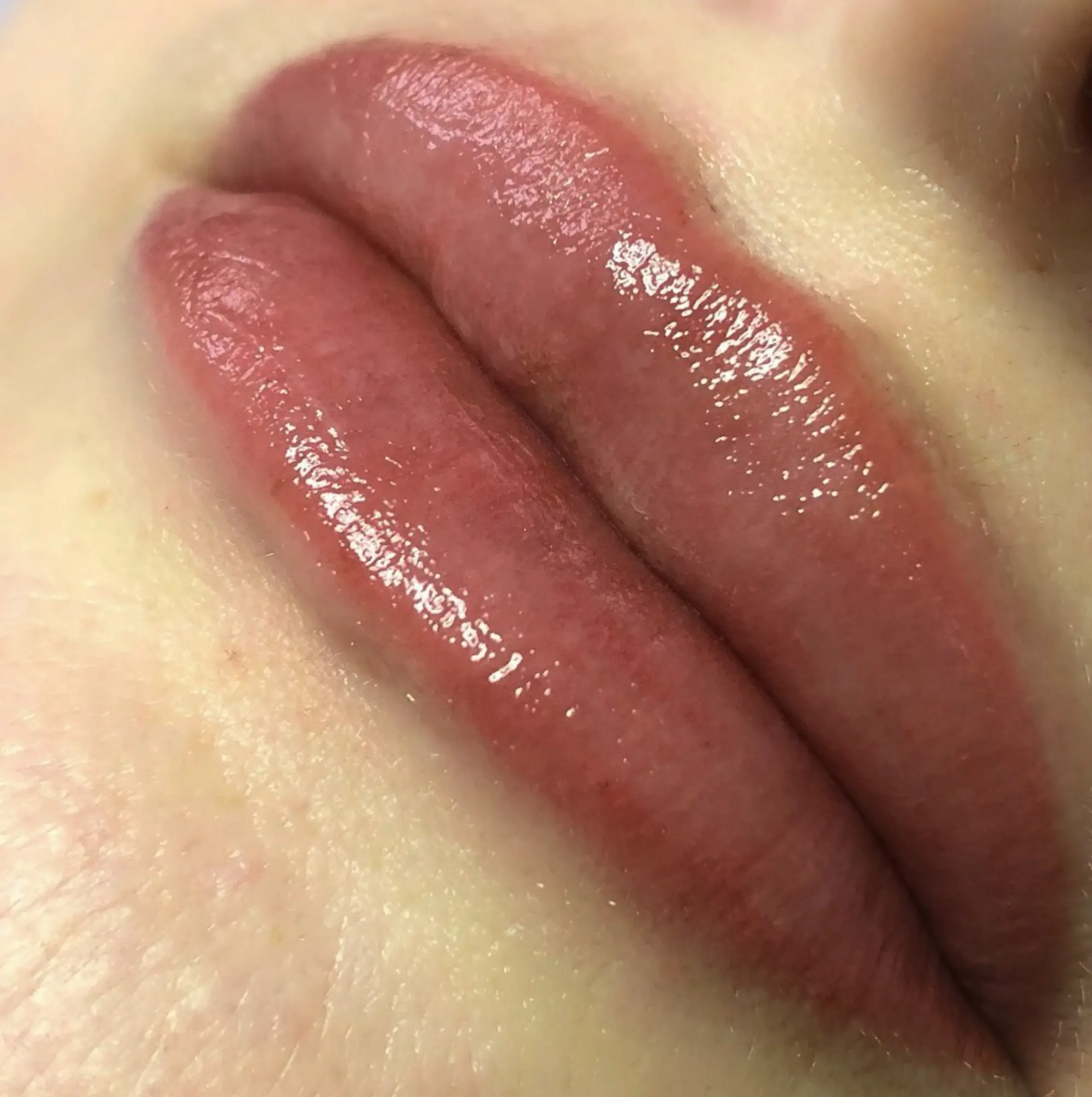Travel and beauty Australia | Lip Tattoo Correction vs Laser Removal: What’s Better?
